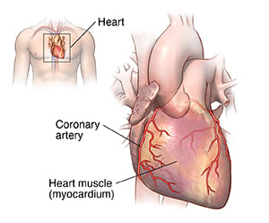 Front view of heart showing coronary arteries and location of heart in body.