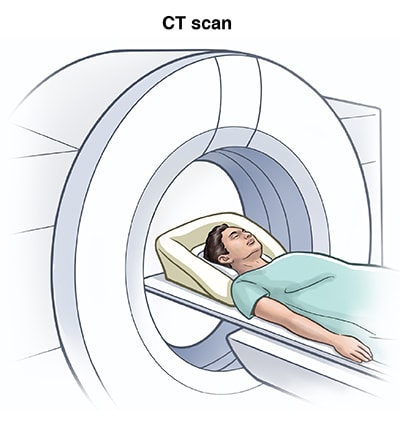 Person on a table having a CT scan of the brain